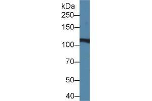 Western blot analysis of Rat Liver lysate, using Rat IREB2 Antibody (2 µg/ml) and HRP-conjugated Goat Anti-Rabbit antibody ( (IREB2 anticorps  (AA 1-343))