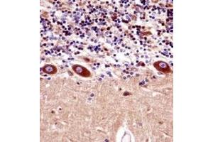 Immunohistochemistry analysis in formalin fixed and paraffin embedded human cerebellum tissuereacted with KCNA1 Antibody (Center) followed which was peroxidase conjugated to the secondary antibody and followed by DAB staining. (KCNA1 anticorps  (Middle Region))