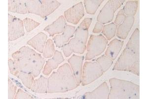 Detection of MYL6B in Rat Skeletal muscle Tissue using Polyclonal Antibody to Myosin Light Chain 6B, Alkali, Smooth Muscle And Non Muscle (MYL6B)