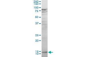 KLRF1 polyclonal antibody (A01), Lot # 051214JC01. (KLRF1 anticorps  (AA 69-166))
