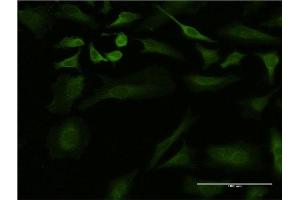 Immunofluorescence of monoclonal antibody to ULK2 on HeLa cell.