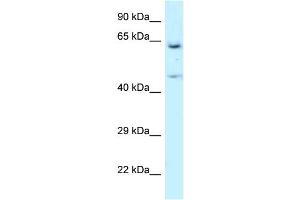 WB Suggested Anti-NARS Antibody Titration: 1. (NARS anticorps  (N-Term))