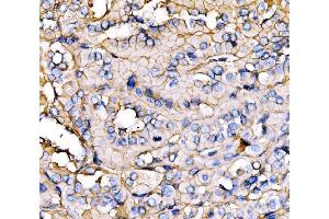 IHC analysis of NEAS/SPTAN1 using anti-NEAS/SPTAN1 antibody (ABIN7600436). (SPTAN1 anticorps  (AA 1916-2472))
