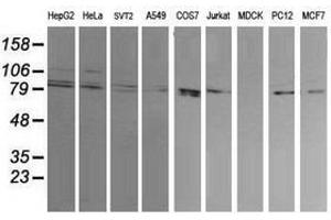 Image no. 2 for anti-Dynamin 1-Like (DNM1L) antibody (ABIN1497871)