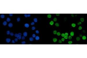 IF analysis of MCM6 using anti-MCM6 antibody (ABIN7600038).