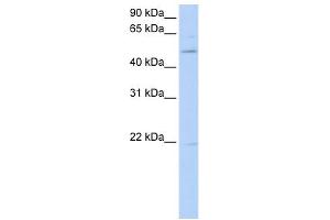 WB Suggested Anti-RORB Antibody Titration:  0. (RORB anticorps  (C-Term))