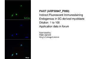 Immunofluorescence --Sample Type: SC derived myoblastsDilution: 1:100