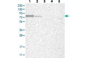 Western blot analysis of Lane 1: RT-4, Lane 2: U-251 MG, Lane 3: Human Plasma, Lane 4: Liver, Lane 5: Tonsil with LARP7 polyclonal antibody  at 1:250-1:500 dilution. (LARP7 anticorps)