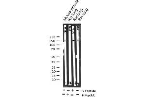 Western blot analysis of Phospho-PLCG2 (Tyr753) expression in various lysates
