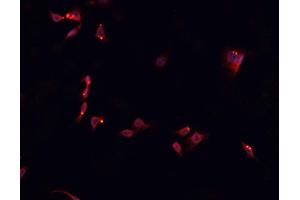 ABIN6266681 staining SNKSH cells by IF/ICC. (NK6 Homeobox 3 anticorps  (Internal Region))