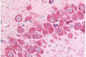 Anti-MINK1 / MAP4K6 antibody  ABIN1049061 IHC staining of rat hippocampus.