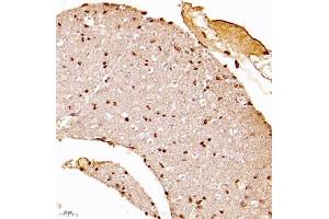 Immunohistochemistry of paraffin embedded mouse spinal cord using USP34 (ABIN7076115) at dilution of 1:700 (400x lens)