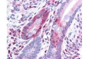 Immunohistochemistry (IHC) image for anti-Programmed Cell Death 4 (PDCD4) (pSer457) antibody (ABIN400797) (PDCD4 anticorps  (pSer457))