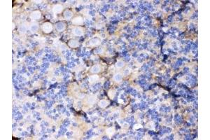 IHC testing of FFPE mouse cerebellum with GLAST antibody. (SLC1A3 anticorps)