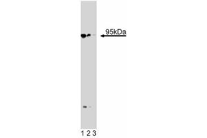 Western blot analysis of Neurotensin Receptor 3 on a PFSK-1 cell lysate (Human neuroectodermal tumor line, ATCC CRL-2060). (Sortilin 1 anticorps  (AA 300-422))