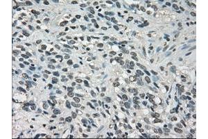 Image no. 7 for anti-Lactate Dehydrogenase A (LDHA) antibody (ABIN1499114)