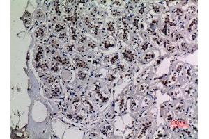 Immunohistochemistry (IHC) analysis of paraffin-embedded Human Breast, antibody was diluted at 1:100. (NF-kB p65 anticorps  (acLys218))