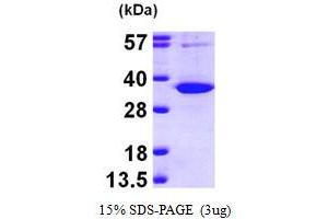 SDS-PAGE (SDS) image for Uridine Phosphorylase 1 (UPP1) (AA 1-310) protein (His tag) (ABIN667819)