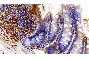 Detection of GAL3 in Rat Colon Tissue using Polyclonal Antibody to Galectin 3 (GAL3) (Galectin 3 anticorps  (AA 1-262))