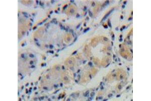 Used in DAB staining on fromalin fixed paraffin-embedded Stomach tissue (UBD anticorps  (AA 1-165))