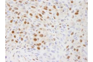 anti-Elongation Factor Tu GTP Binding Domain Containing 2 (EFTUD2) (AA 1-50) antibody