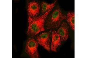 IF analysis of RAD50 using anti-RAD50 antibody (ABIN7599857) and anti-Tubulin Alpha antibody (ABIN7600339).