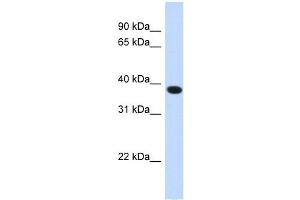 ACBD4 antibody used at 1 ug/ml to detect target protein. (ACBD4 anticorps  (N-Term))