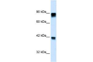 WB Suggested Anti-RB1 Antibody Titration: 0. (Retinoblastoma 1 anticorps  (C-Term))