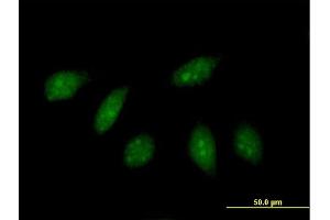 Immunofluorescence of purified MaxPab antibody to HLX on HeLa cell. (HLX anticorps  (AA 1-488))