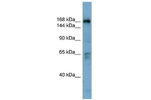 WB Suggested Anti-DOCK2 Antibody Titration: 0. (DOCK2 anticorps  (Middle Region))