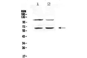 Western blot analysis of AMPK alpha 1 using anti-AMPK alpha 1 antibody .
