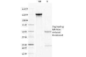 SDS-PAGE Analysis Purified CD22 Mouse Monoclonal Antibody (LPFS2/1611). (CD27 anticorps)