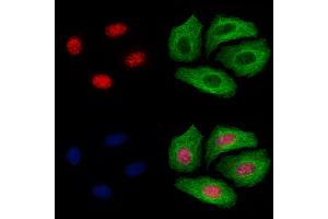 ABIN6255193 and ABIN6267396 staining Hela cells(4h of LPS treatment) by IF/ICC.