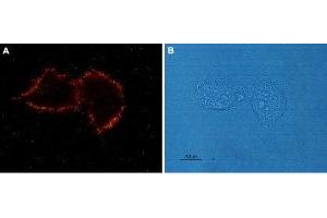 Expression of AGTR1 in rat C6 glioma cells - Cell surface detection of AGTR1 in live intact rat C6 glioma cells.
