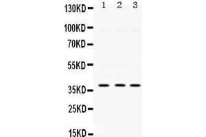 Western Blotting (WB) image for anti-Protein Kinase, AMP-Activated, beta 1 Non-Catalytic Subunit (PRKAB1) (AA 32-68), (N-Term) antibody (ABIN3043359) (PRKAB1 anticorps  (N-Term))
