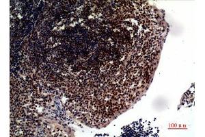 Immunohistochemistry (IHC) analysis of paraffin-embedded Human Tonsilla, antibody was diluted at 1:100.