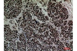 Immunohistochemistry (IHC) analysis of paraffin-embedded Human Pancreas, antibody was diluted at 1:100.