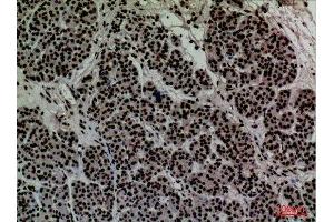 Immunohistochemistry (IHC) analysis of paraffin-embedded Human Pancreas, antibody was diluted at 1:100. (CD2 anticorps  (N-Term))