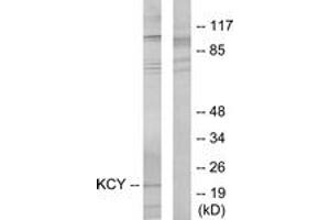 Western blot analysis of extracts from HeLa cells, using KCY Antibody. (KCY (AA 1-50) anticorps)