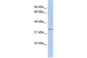 WB Suggested Anti-ODF4 Antibody Titration: 0. (ODF4 anticorps  (N-Term))