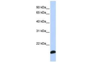 Image no. 1 for anti-Peroxiredoxin 5 (PRDX5) (C-Term) antibody (ABIN6741267) (Peroxiredoxin 5 anticorps  (C-Term))