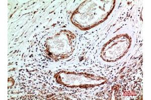 Immunohistochemistry (IHC) analysis of paraffin-embedded Human Brain, antibody was diluted at 1:100.