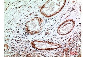 Immunohistochemistry (IHC) analysis of paraffin-embedded Human Brain, antibody was diluted at 1:100. (IL1R1 anticorps  (N-Term))