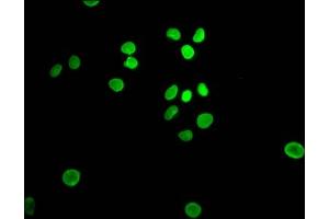 Immunofluorescence staining of Hela Cells with ABIN7127462 at 1:50, counter-stained with DAPI.