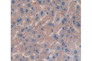 IHC-P analysis of Kidney tissue, with DAB staining. (Complement Factor I anticorps  (AA 358-603))