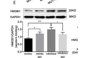 HMGB1 was a direct target of miR-339-5p. (GAPDH anticorps)