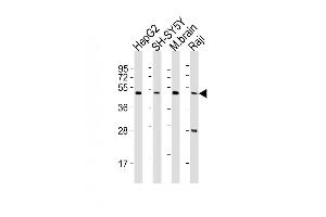 All lanes : Anti-CTBP1 Antibody (C-term) at 1:2000 dilution Lane 1: HepG2 whole cell lysates Lane 2: SH-SY5Y whole cell lysates Lane 3: mouse brain lysates Lane 4: Raji whole cell lysates Lysates/proteins at 20 μg per lane. (CTBP1 anticorps  (C-Term))