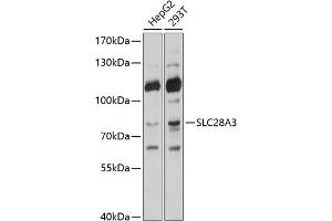 Western blot analysis of extracts of various cell lines, using SLC28 antibody (ABIN6133437, ABIN6147944, ABIN6147945 and ABIN6214531) at 1:1000 dilution. (SLC28A3 anticorps  (AA 612-691))