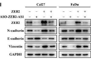 Reintroduction of exogenous ZEB2 largely attenuated the phenotypical changes induced by ZEB2-AS1 inhibition. (Vimentin anticorps)