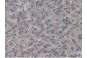 IHC-P analysis of Human Liver Tissue, with DAB staining. (CLEC10A anticorps  (AA 71-239))